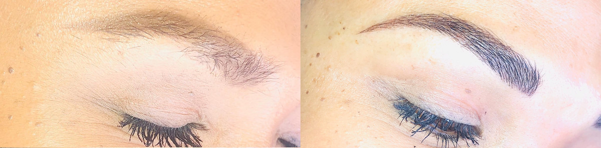 Microblading Before and After Photo by Dr. White in Charlotte North Carolina