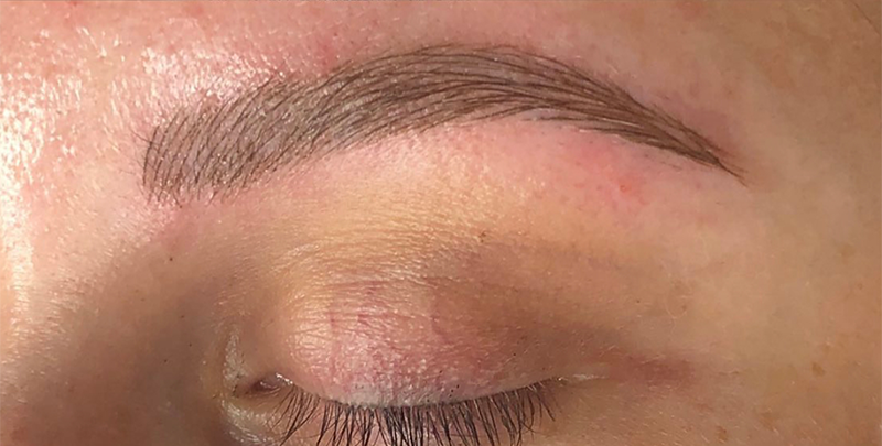 Microblading Before and After Photo by Dr. White in Charlotte, NC 