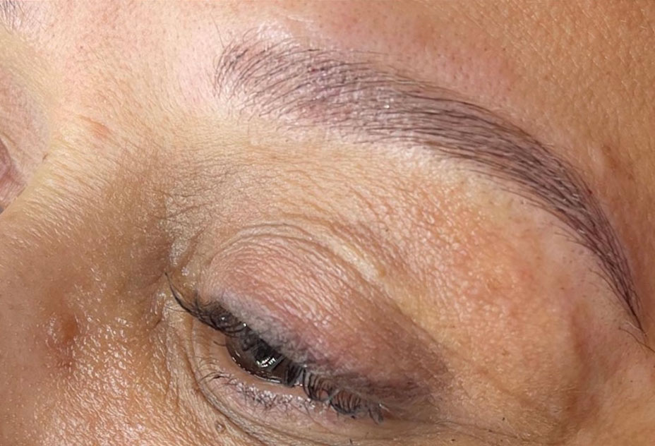 Microblading Before and After Photo by Dr. White in Charlotte, NC 