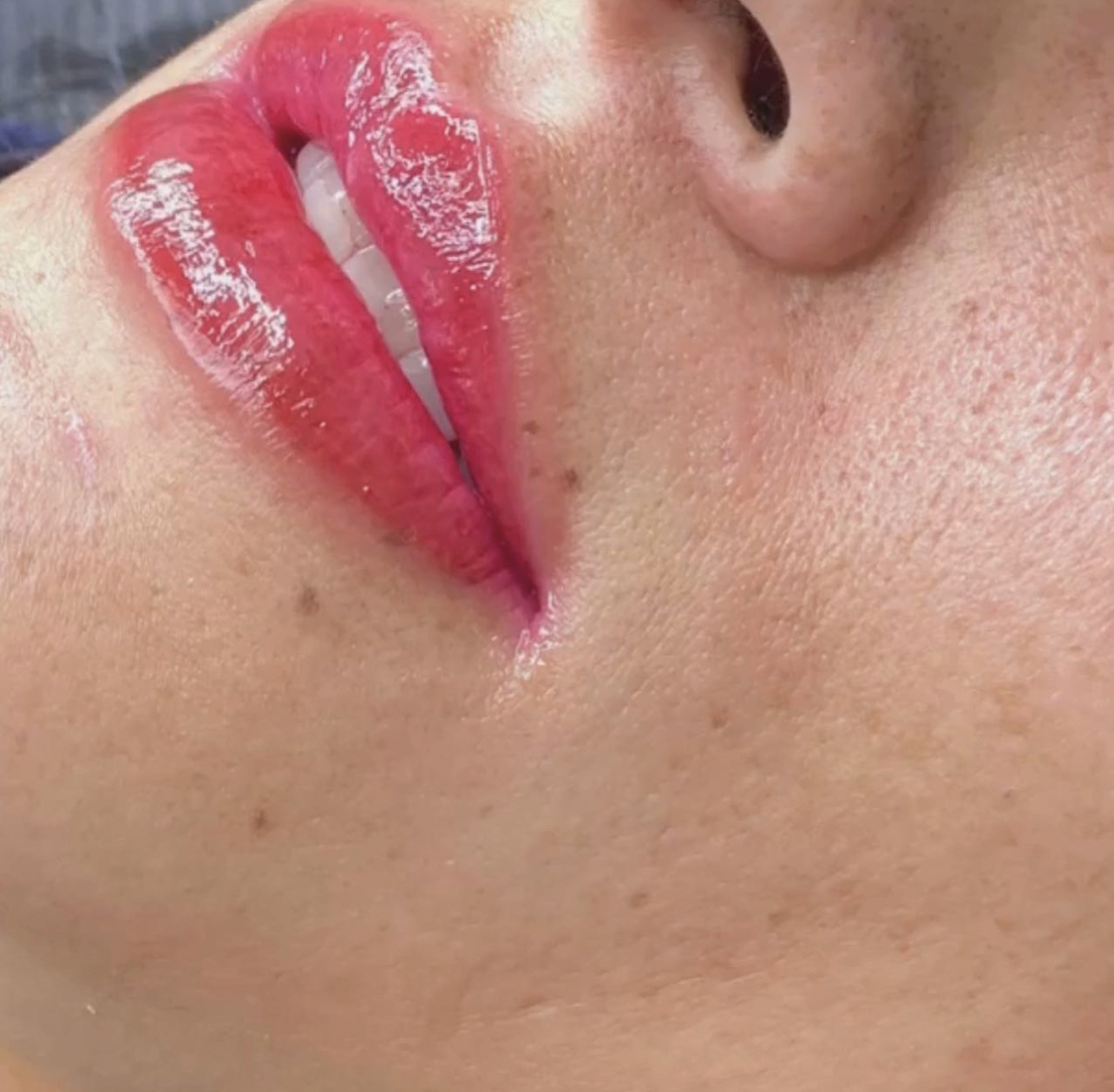 Lip Blushing & Lip Liner After Photo by Dr. White in Charlotte North Carolina